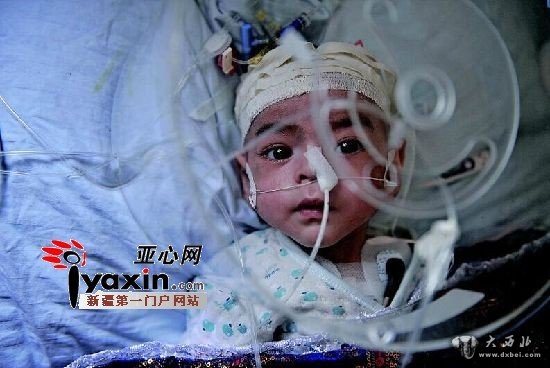 六个月大男婴挣扎生死线 父母四处筹钱“做梦都想把孩子治好”