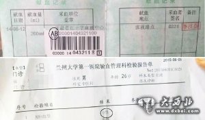 小王的献血证与医院的检验单显示的是不同血型（画圈处）。